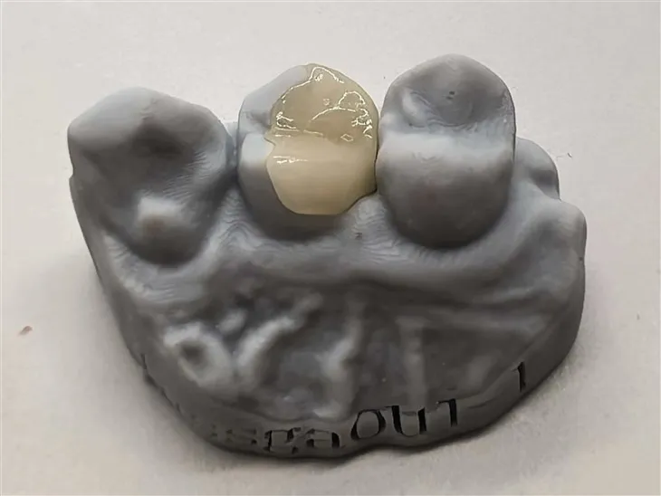 Autentisk kompositonlay til en bedre pris